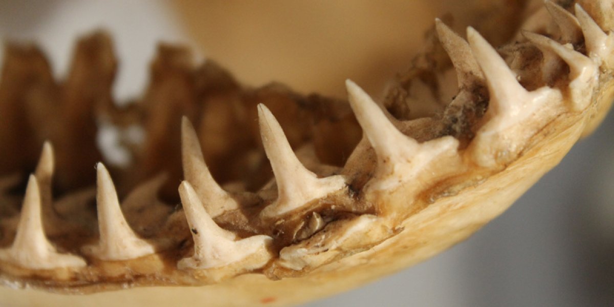 Отдых, обернувшийся кошмаром: неизвестная рыба откусила кусок ноги туристке на пляже в Испании Отдых, обернувшийся кошмаром: неизвестная рыба откусила кусок ноги туристке на пляже в Испании