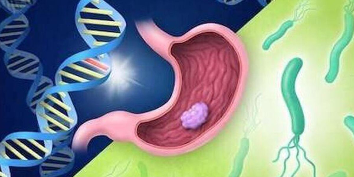 Невидимый враг в желудке: H. pylori названа главной причиной грядущей волны рака