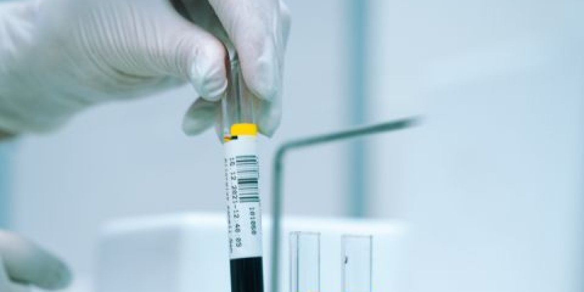 Революция в проверках на опьянение: что ждет россиян с 1 сентября 2025 года