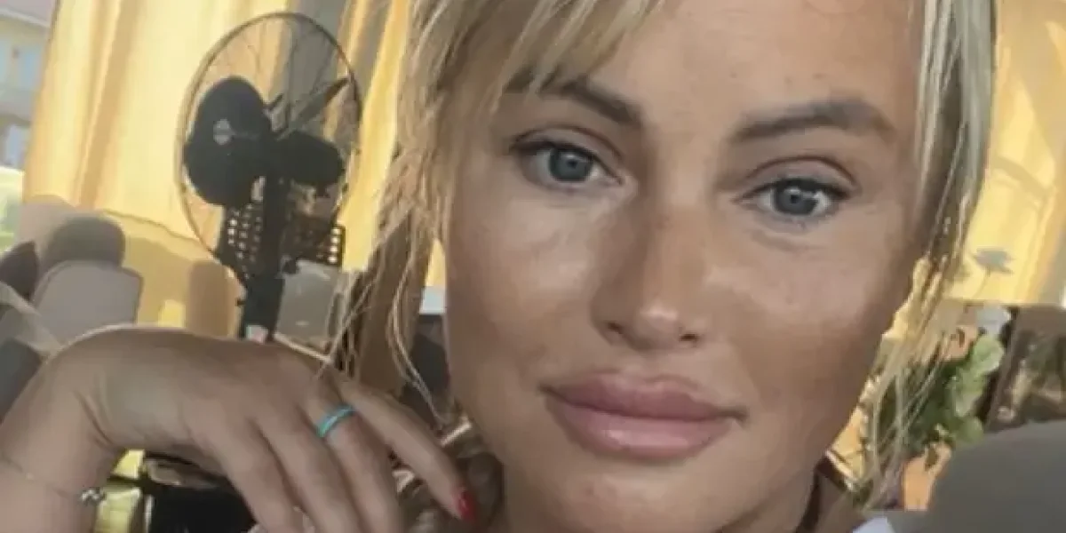 «Чувствую себя старушкой»: Дана Борисова о последствиях новой пластики