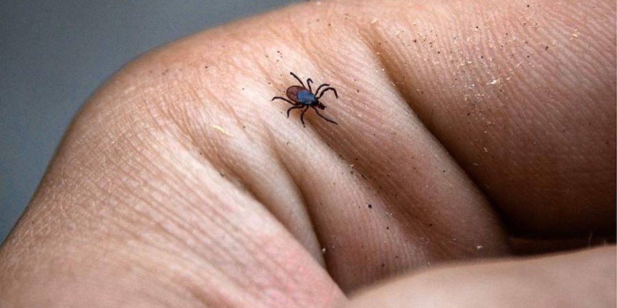 Опасные трофеи лета: В Подмосковье зарегистрировано свыше 11 тысяч укусов клещей Опасные трофеи лета: В Подмосковье зарегистрировано свыше 11 тысяч укусов клещей