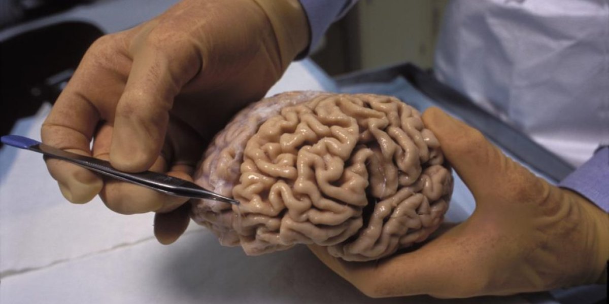 Застенчивость оказалась не просто чертой характера: что обнаружили ученые в мозге скромных людей